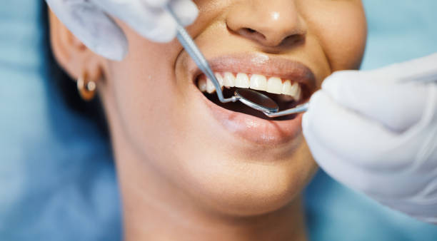 Best Emergency Dentist for Special Needs Patients in Blackhawk, CA