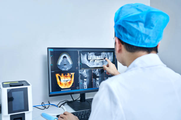Best Emergency Dental Extractions in Blackhawk, CA